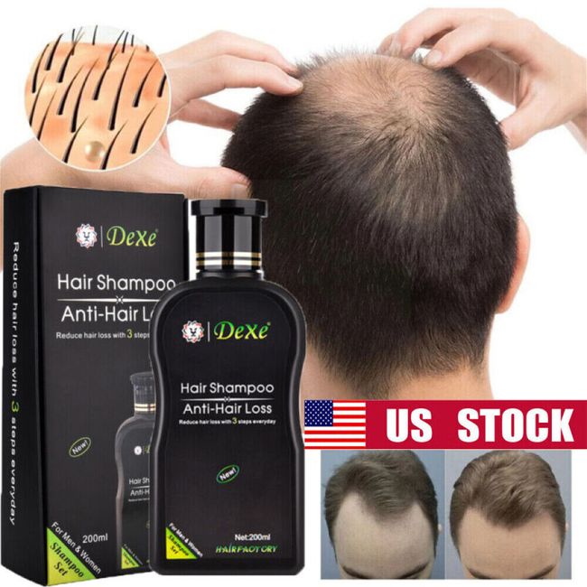 Dexe Hair Shampoo Anti hair Loss Treatment Fast Hair Growth For Men & Women