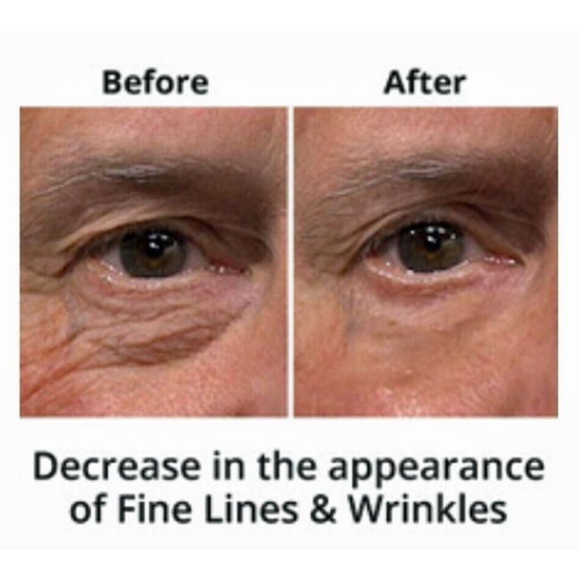 Remove Dark Circles,Bags & fine Lines w/clinical strength under eye cream #NIB