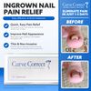 CurveCorrect® Ingrown Toenail Treatment Kit - Effective Ingrown Toenail Corrector Kit with 10 Braces - at Home Ingrown Toenail Relief - Big Toe Ingrown Nail Treatment - Pain Relief Solution