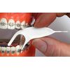 Platypus Orthodontic Flossers for Braces Unique Structure Fits Under Arch Wire, Floss Entire Mouth in Less Than Two Minutes, Increases Flossing Compliance - 30 Count Bag (Pack of 4)