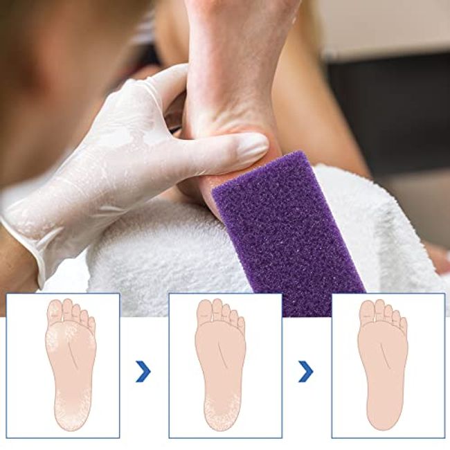 Pumice Stone for Feet Callus Remover Foot Scrubber & Exfoliator