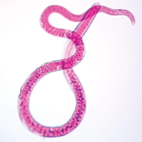 Carolina Trichinella Spiralis Female Microscope Slide, Parasitic Nematode, Glass, 1000x Magnification