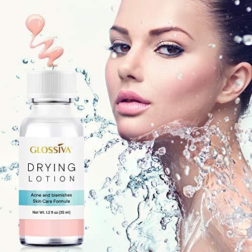 Glossiva Drying Lotion, Acne Spot Treatment Dries Out Pimples, Blemishes, Zits, and Clogged Pores