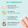 #OOTD Caredermthin 2-Step Spot Patch (144 Dots) - Korean Skincare Patch Set for Targeted Blemish Care – Pre & Post Care