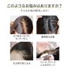 HIYE ウィッグ 人毛100% 頭頂部 自然 分け目 つむじ付き 軽量 トップカバー 部分ウィッグ ショット 白髪隠し 薄毛隠し 増毛 前髪 かつら 女性 小顔 円形脱毛症 医療用ウィッグ 黒髪 横9cm縦14cm (20CM-自然色)