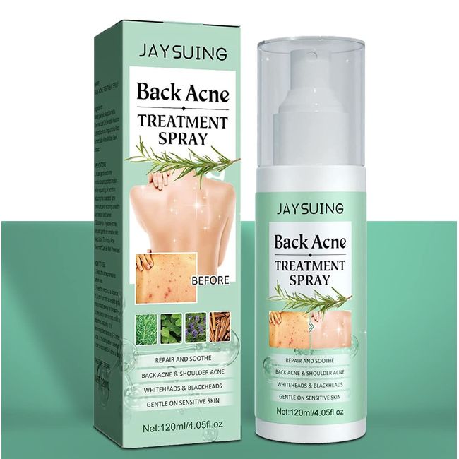 Back Acne Treatment, Back Acne Spray, 2% Salicylic Acid Spray, Body Acne Treatment with Herbal Formula, Body Acne Spray, Tea Tree Oil Spray, Acne Treatment For Teens, Back Acne Solution