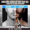 Beard Growth Kit for Men, Beard Growing Kit & Mustache Growth Kit, Beard Roller Kit - Includes Beard Growth Oil Balm, Derma Roller Accessory, Beard Growth Serum & Wooden Double Sided Comb