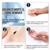 DermaEX  Liquid Wart & Corn Remover Mask 