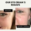 Under Eye Cream for Dark Circles and Puffiness - Hydrating Anti Aging Eye Cream for Wrinkles with Hyaluronic Acid + Vitamin E, Under Eye Serum Moisturizer, Vacation Essentials Eye Treatment Products