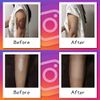 Foundation Tape (Conceals Dark Scars), 10 Pieces, Pink Ochre, Conceals Wrist Cutting Scars, Waterproof, Matte, Skin Tone Sheets, Made in Japan, Login My Life, Patented