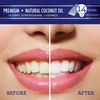 GuruNanda Teeth Whitening Strips with Coconut Oil - 14 Enamel Safe Strips for Sensitive Teeth - Non-Slip, Dry Strip Technology for Whiter Teeth - 7 Professional Treatments with 30 Minutes Fast Results
