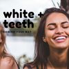 Teeth Whitening Trays Moldable Mouth Trays 4 Dental Tray Form Shape Perfectly 2 Travel Storage Cases Included Fit Upper Lower Tooth Bleaching Moldable Guards Compatible with Opalescence Gel