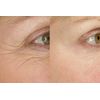 Candida support - ANTI PARASITE – ANTI WRINKLE COMBO - coenzyme b complex