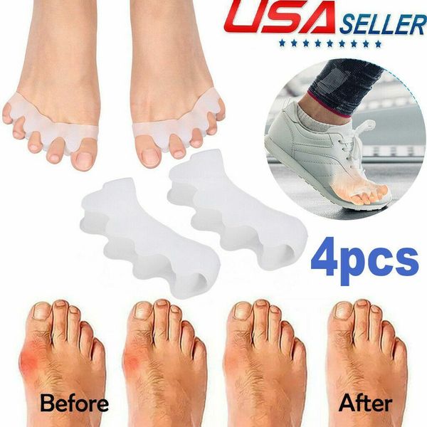 4X BIG Toe Bunion Corrector Splint Straightener Hammer Pain Relief Hallux Valgus