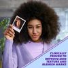 Purifide by Acnecide Post-Breakout Serum, 30ml, With Niacinamide and Bakuchiol for Hyperpigmentation and Spot-prone Skin
