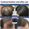 4Pack Minoxidil 5% Extra Strength Hair Regrowth Solution 4 Month Supply For Men