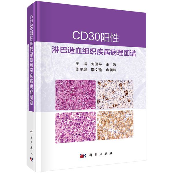 CD30阳性淋巴造血组织疾病病理图谱 刘卫平 王哲著