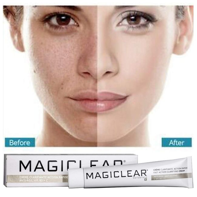 MAGICLEAR Luxury blemish spot treatment Cream - Dark spot corrector remover cream. Organic spot treatment. Best Swiss brand 50 ml.