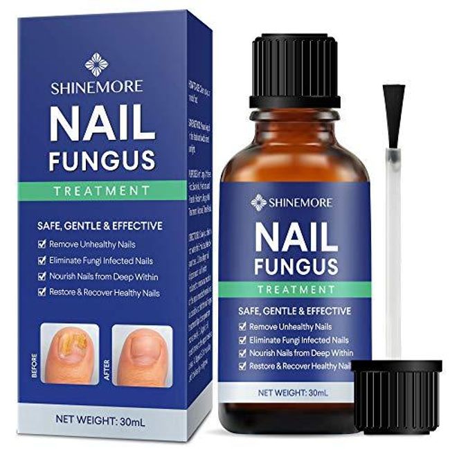 Nail Fungal Treatment, EXTRA STRONG Finger & Toenail Fungal Treatment
