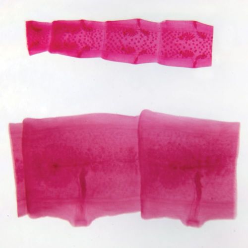 Carolina Tapeworm Proglottids Comparison Slide, Microscope Slide with Mature Proglottids of Dipylidium and Taenia for Comparison, Glass, 600x Magnification