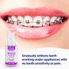 OrthoFoam Braces Cleaner - Cleans Under Metal, Ceramic or Clear Brackets & Wires. Can Brush or Rinse with & Use in Trays. Foaming Bubbles Whiten Teeth & Fight Plaque (2 Pack - 25 ml)