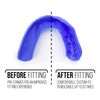 Electric Blue SISU 3D Junior Mouth Guard