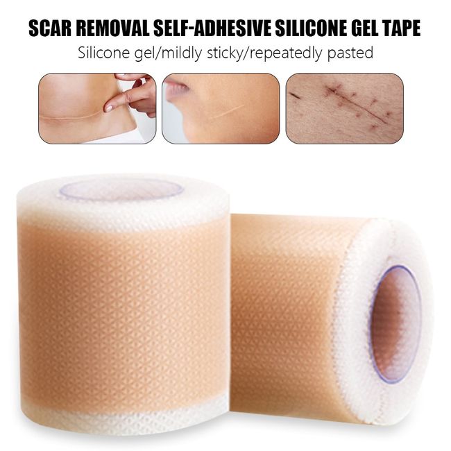 Efficient Beauty Scar Removal Silicone Self-adhesive Silicone Tape Patch