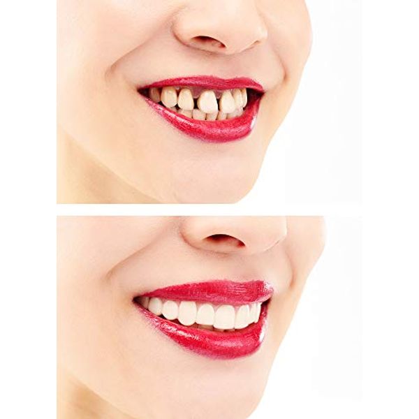 One Touch Smile One-Touch Smile Beauty Tooth, Simple, Instant Dentures, False Teeth, Tooth Cover, Upper Teeth, Unisex, Easy to Install, Located Teeth