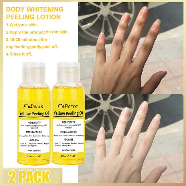 2X 30ML Body Dark Skin Whitening Oil Knuckle Bleaching Peeling Dark Spot Removal