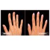 Perfect Formula Nail Collection - The Perfect Keratin Nail Treatment Manicure - A "Suit of Armor for Your Nails" - 4 pieces.