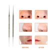 YNR Blackhead Remover Tool Whitehead Pimple Extractor Acne Comedone Spot Popper Tool