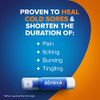 Abreva 10 Percent Docosanol Cold Sore Treatment, Treats Your Fever Blister in 2.5 Days - 0.07 oz Pump