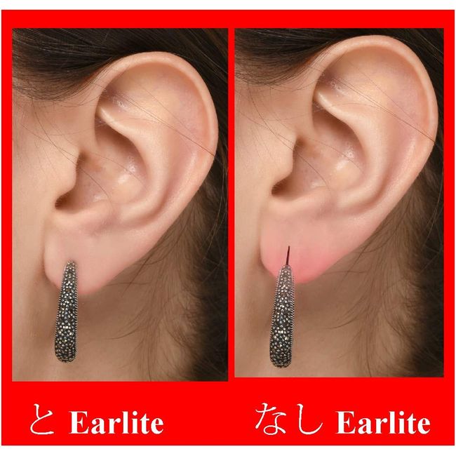 Lobe Wonder 120 Earring Support Patches - 2 Pack