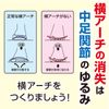 Toe Plays Walking Comfortable Support For Bunions Antigravity Pinky Fixed Type Foot 1 Piece Right One Size Fits Most (22 ~ 26 cm) Beige