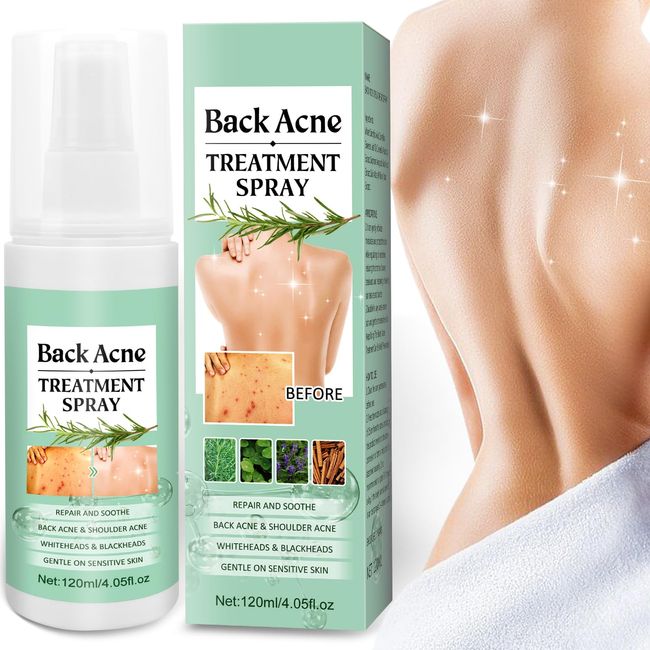 Back Acne Treatment Spray - Back Acne Spray Acne Treatment with Herbal Formula, 2% Salicylic Acid & Tea Tree Oil Body Acne Spray for Teens, Body Back Acne Solution, 120ml