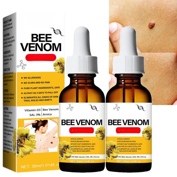 2pcs Bee Venom Wart and Tag Remover,Bee Venom Mole and Wart Treatment Cream for Face,Wart and Mole Remover,Bee Venom Wart and Tag Remover Essence,Easy Application & No Irritation