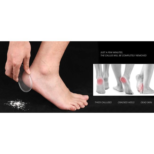 Glass Foot File Callus Remover - Foot Scrubber Heel Scraper for Dead Skin  Remova