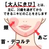【第2類医薬品】ラウマーアクネクリーム 18g