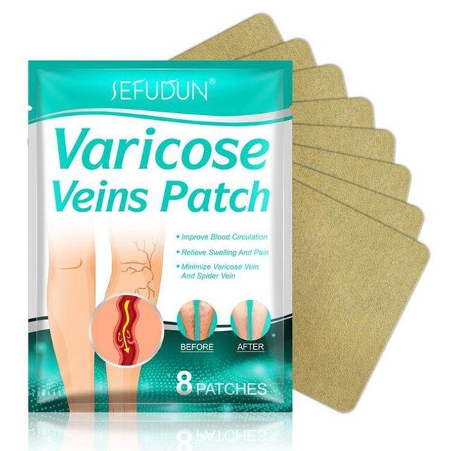 Athlete's Foot Laser Varicose Veins Patch Leg Vasculitis Relief Improvement for Spider Legs Blood Foot Health Care