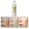Toner for Dark Spots Turmeric Dark Spot Corrector Toner, Facial Toner for Acne Prone Skin, Dark Spot Remover for Face Hydrating Face Toner for Women, Hyperpigmentation Treatment for Dry Oily Skin 4OZ