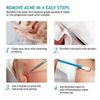 9 PCS Blackhead Remover Pimple Popper Tool Kit, Black Head Removal Extractor