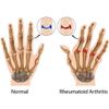 2PAIRS Copper Arthritis Compression Gloves Hand Carpal Support Joint Pain Relief