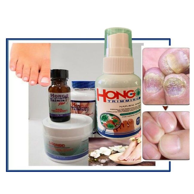 HONGO TRIMIN KIT ORIGINAL ANTI FUNGAL ZANA HONGOS UNAS NAIL SUPPORT FORMULA