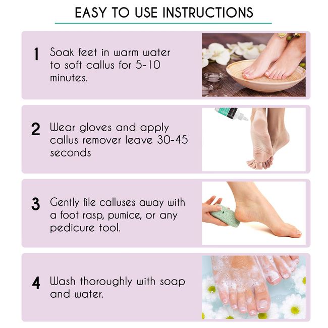 8oz Callus Remover Gel and Foot File/Foot Rasp Spa Kit