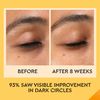 Bliss Rest Assured ™ Eye Cream with Vitamin C & Caffeine - 0.5 Fl Oz - Dark Circle Reducing & Depuffing Eye Cream - Clean - Vegan & Cruelty-Free