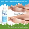 Sanical Moisturizing Callus Remover 16 oz