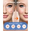 LitBear Acne Pimple Patches- Day and Night 4 Sizes 180 Dots Thin & Thick Hydrocolloid Patches with Witch Hazel, Tea Tree & Calendula Oil, Extra Adhesion for Face Zit Patch Dots