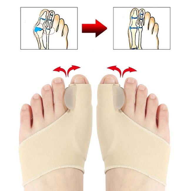 Gel Toe Stretcher & Toe Separators, Bestrice Bunion Corrector, Toe Pro –  EveryMarket