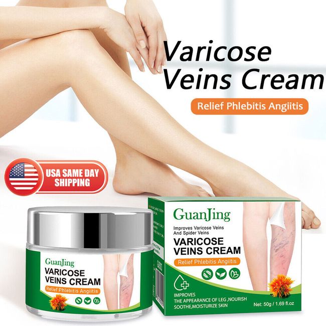 Varicose Veins Cream Spider Pain Relief Phlebitis Angiitis Inflammation Blood
