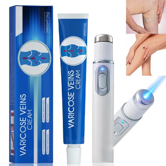 Varicose Veins Treatment Set,Blue Light Pen for Varicose Veins,Anti Varicose Vein Soothing Leg Treatment Pen,Spider Veins Repair Cream for Leg,Vein Cream for Legs Aching Legs Relief,Leg Vein Cream